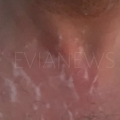 Το τσίμπημα που μετέτρεψε το μπάνιο σε εφιάλτη